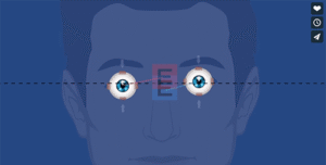 what is bvd thumb v1